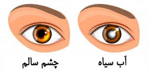 آب سیاه چشمی